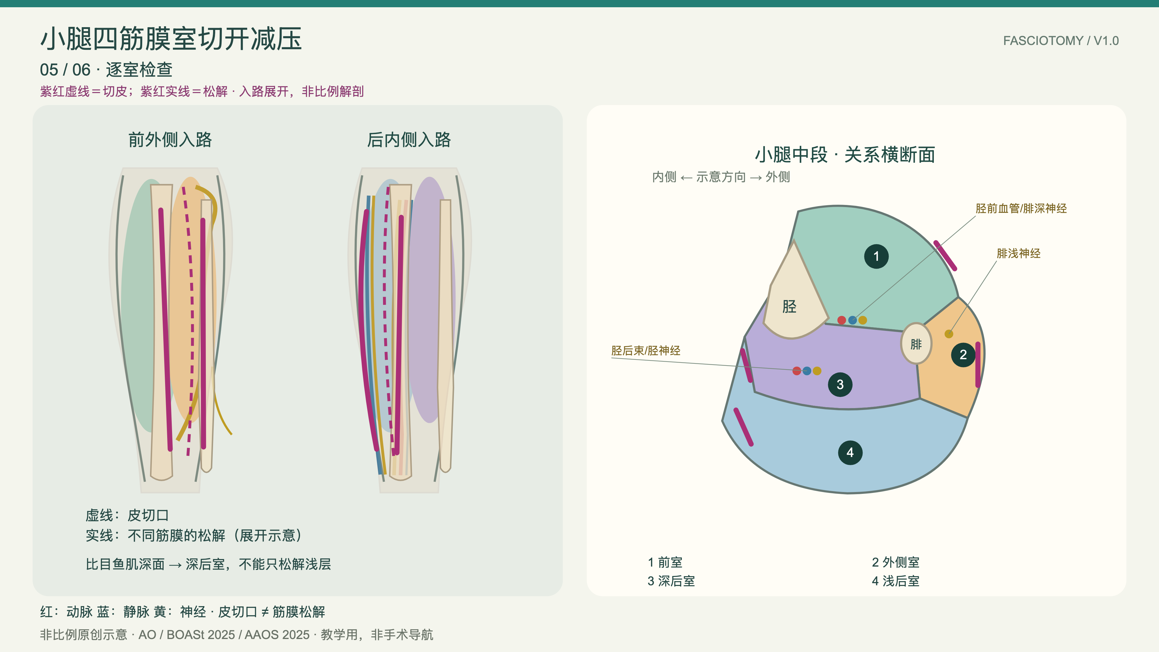 小腿筋膜室横断面复核预览