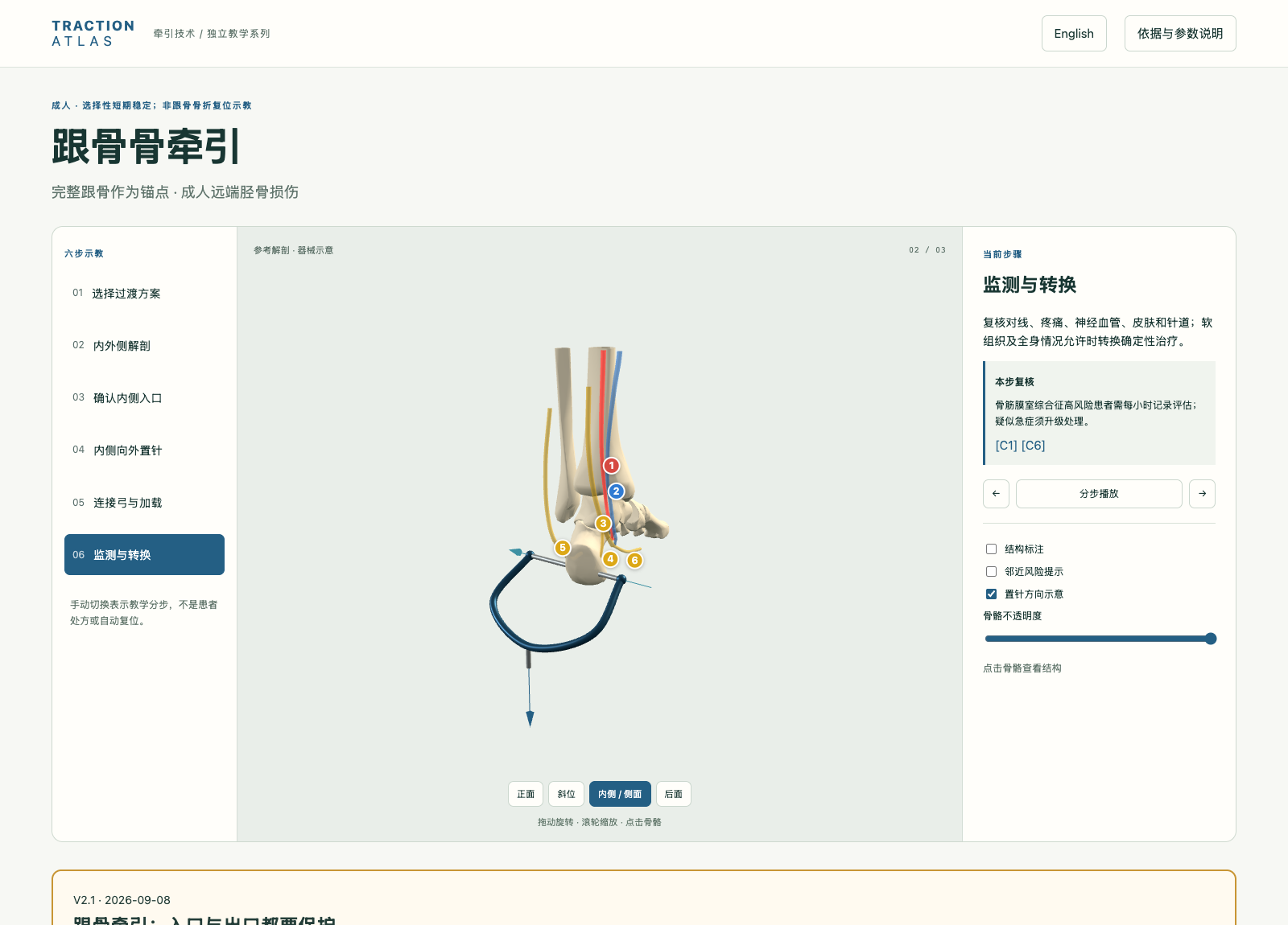 跟骨骨牵引三维教学图