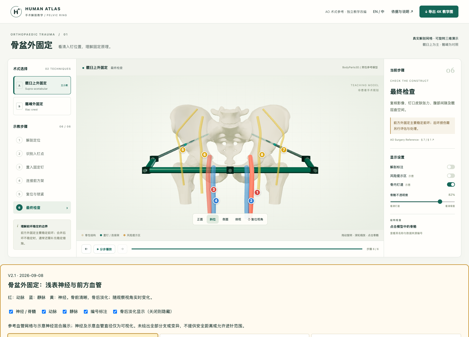 骨盆外固定三维教学预览
