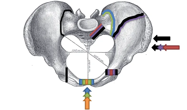 Young-Burgess pelvic fracture classification